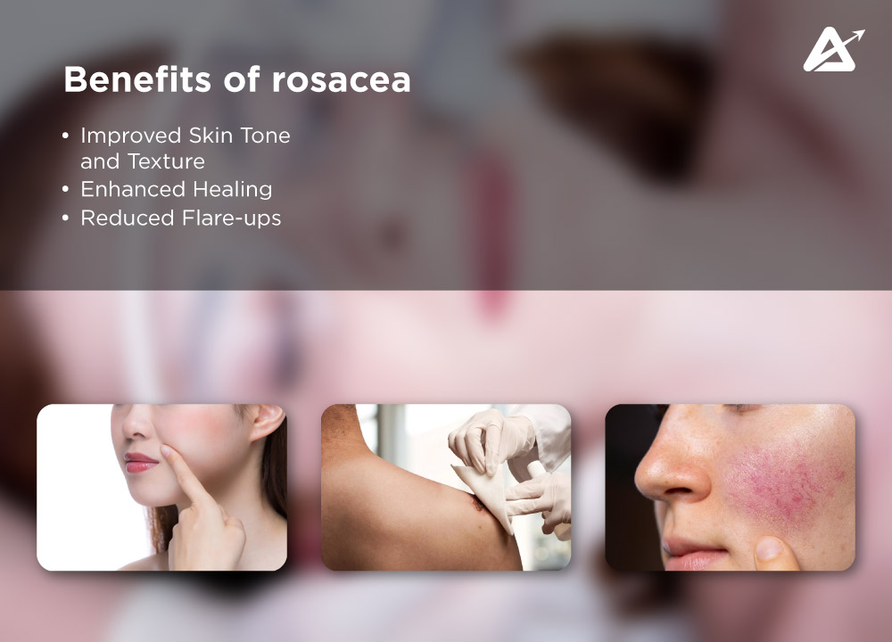 benefits-of-red-light-therapy-for-rosacea-red-light-therapy-rosacea-before-and-after