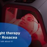 led light therapy for Rosacea