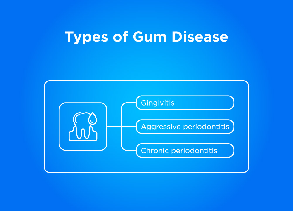 Types of the best mouthwash for gum disease.