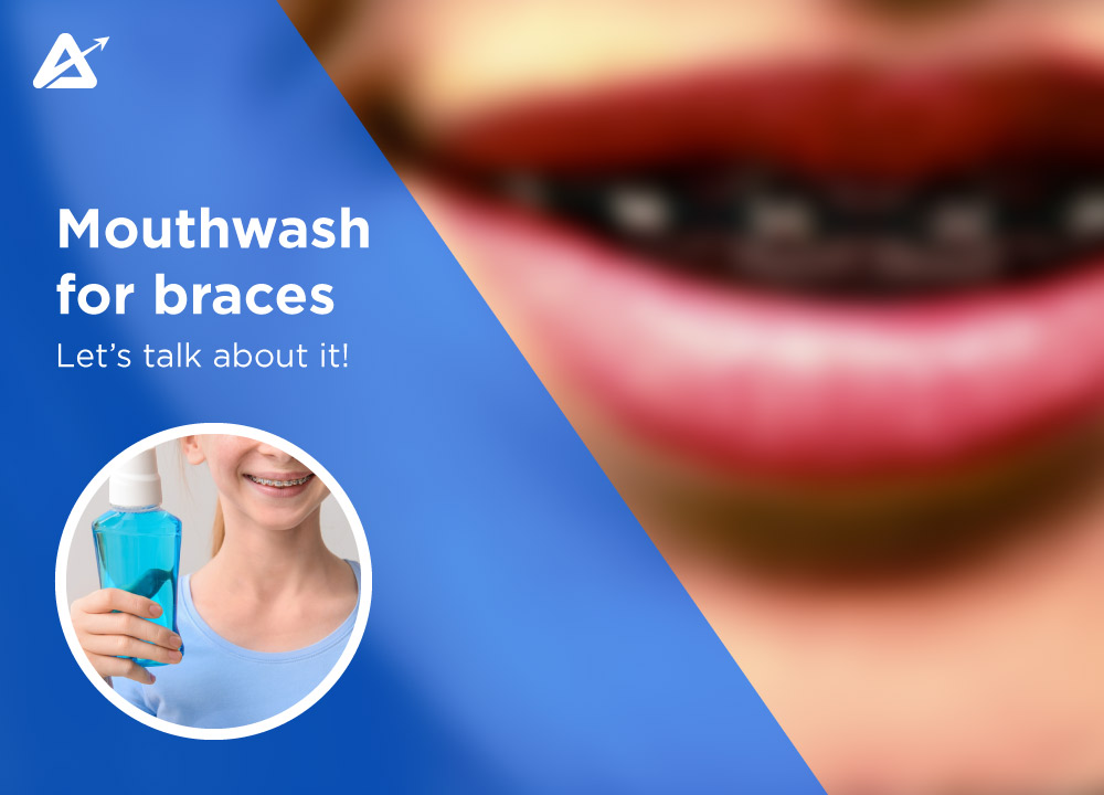 Best mouthwash for braces