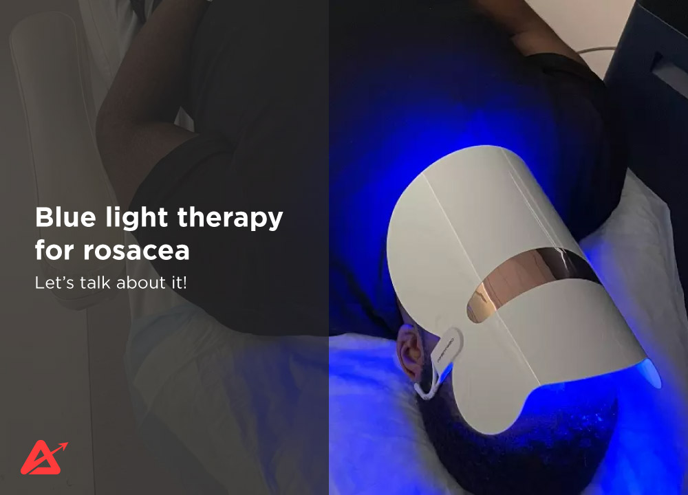 Blue light therapy for rosacea