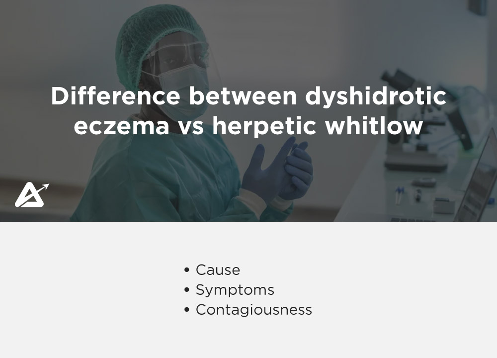  difference between dyshidrotic eczema vs herpetic whitlow