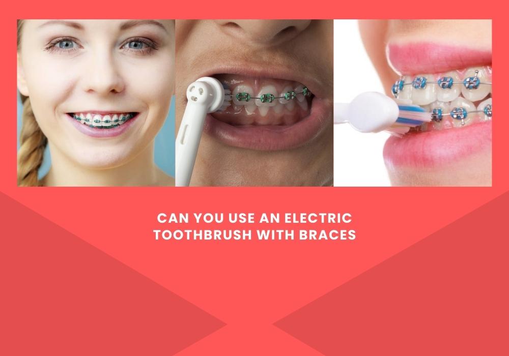 Can you use an electric toothbrush with braces